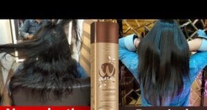 How to take care of hair after nanoplastia How to take care of hair after nanoplastia