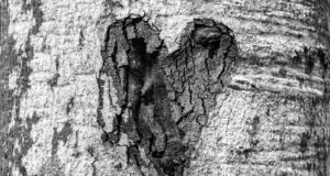 scars to your scars to your